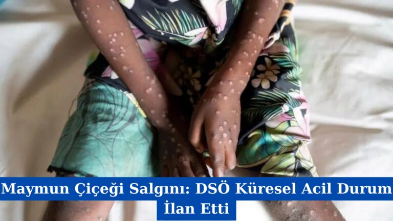 Maymun Çiçeği Salgını: DSÖ Küresel Acil Durum İlan Etti