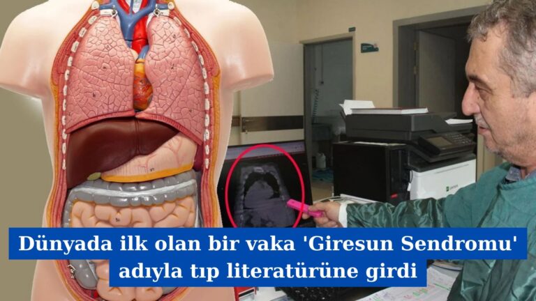 Dünyada ilk olan bir vaka ‘Giresun Sendromu’ adıyla tıp literatürüne girdi